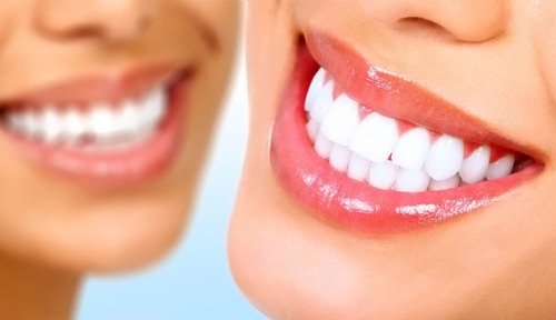 Красивые белые зубы
